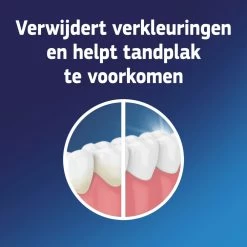 6x Fixodent Reinigingstabletten Complete Care -Huidverzorgingswinkel 998573 3